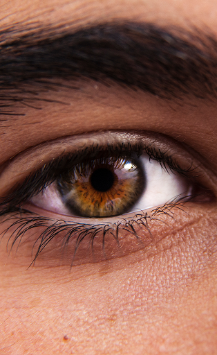 Dry Eye Image